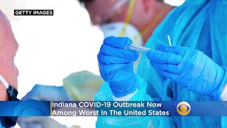 Indiana COVID19 Outbreak Now Among Worst In The United States [upl. by Aidin]