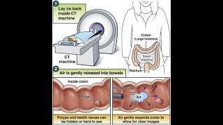 CT Colonography CT scan abdomen [upl. by Ymmak]