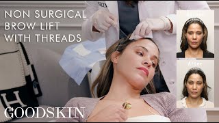 NonSurgical Brow Lift with Threads — Inside The Treatment Room  GOODSKIN [upl. by Taam134]