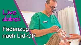 AugenlidOP – Erfahrungsbericht Fäden ziehen nach SchlupflidOP bei Dr Günther Düsseldorf [upl. by Bonns]