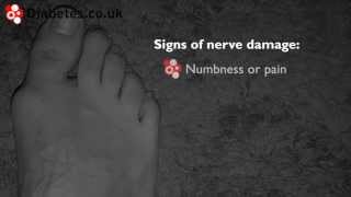 How to Check Your Feet For Signs of Nerve Damage [upl. by Saied87]