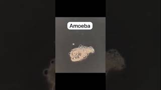 amoeba nutrition in amoeba ingestion of food through pseudopodia amazing animals protozoa [upl. by Assillem204]