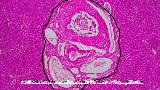 Schistosoma mansoni in Liver with Haematoxylin and Eosin HampE Stain [upl. by Heddie]