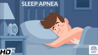 Sleep Apnea CausesSigns and Symptoms DIagnosis and Treatment [upl. by Nylarat]