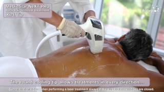 MeDioStar NeXT PRO XL  Training video for hair removal with SMOOTHPULSE mode from Asclepion [upl. by Godden]