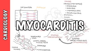 Myocarditis  causes pathophysiology investigation and treatment [upl. by Yrrej]