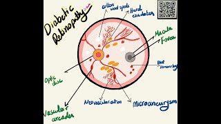 Retinal Abnormalities findings in Ophthalmoscope Examination  Made Easy   مشاكل الشبكية [upl. by Ailadgim318]