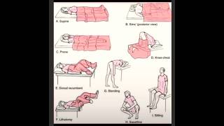 MEDICAL POSITION OF PATIENT FUNDAMENTAL POSITION nursing [upl. by Ynettirb556]