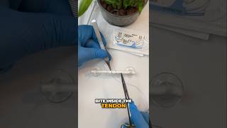 Tendon Repair Masterclass tendon orthopedics plasticsurgery handtrauma flexor kesser doctor [upl. by Olegnalehcim537]