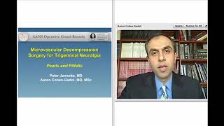 Microvascular Decompression Surgery for Trigeminal Neuralgia Preview [upl. by Dorinda]