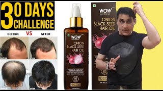 WOW Onion Hair Oil With Black Seed Oil  No More Hair Fall  How To Use Onion Oil For Hair Growth [upl. by Rosina]