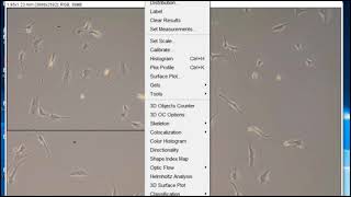 Cell counting and scale bars using ImageJ [upl. by Cristin]