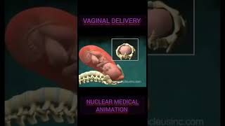 Vaginal Delivery Birth Animation Nuclear Medical digestivesystem surgerysimplified birth [upl. by Parthinia]