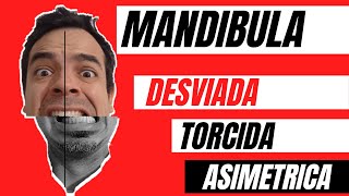 POR QUE TENGO LA CARA TORCIDA ¿como se corrige la asimetría facial ¡MANDÍBULA DESVIADAAUXILIO [upl. by Drofliw21]