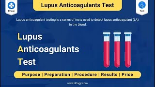 lupus anticoagulant test سلسلة فيديوهات علم المختبر [upl. by Haneekas]