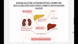 SGLT 2 Inhibitor Associated euglycemic Diabetic Ketoacidosis [upl. by Eurydice]