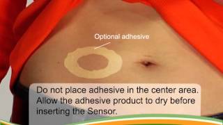 Dexcom G4 PLATINUM Pediatric Inserting Your Sensor [upl. by Zusman]