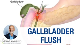 Gallbladder Flush  The true science behind the myth [upl. by Ebbarta]