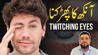 Stop Your Eye Twitching For Good  Aankh Phadakna  Urdu amp Hindi [upl. by Mirielle]