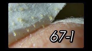 MOST EXCLLENT PORESTRIP 671 FEATURING NOSE 15 [upl. by Amliw]