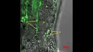 The Hydroid Polyp Stolon Junction Relationship of Anchors to Mesoglea [upl. by Eve790]