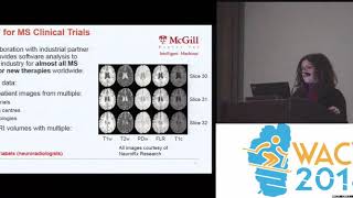 WACV18 Keynote Probabilistic Machine Learning for Lesion and Tumour Detection  Tal Arbel [upl. by Anuska]