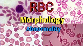 RBC Morphology  Anisocytosis Poikilocytosis  RBC shape amp Size Abnormality [upl. by Staffard]