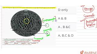 Look at the given figure and find out the statements wrong regarding the gemmule [upl. by Meurer590]