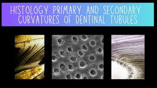 Histology of Primary and Secondary Dentinal Tubule Curvatures  Dentistry [upl. by Eidualc376]