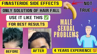 FINASTERIDE Side Effects RESULTS after 2 years use  Only SOLUTION of hairfall [upl. by Ahsatniuq]