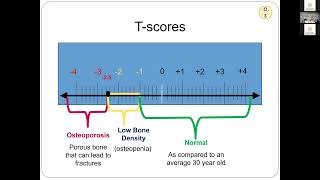 T Score explained [upl. by Cameron782]