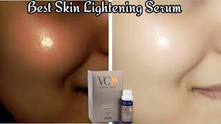 चेहरे के काली परत को निकाल देता है  VC 15 vitamin c serum review  cipla  skin whitening serum [upl. by Mallon]