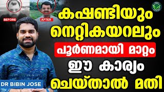 നെറ്റികയറലും കഷണ്ടിയും പൂർണമായി മാറ്റാൻ ഈ കാര്യം ചെയ്‌താൽ മതി  kashandi maran malayalam tips [upl. by Tally]