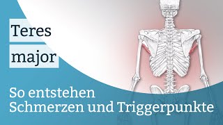 Teres major Schmerzen Triggerpunkte und deren Aktivierung [upl. by Wandy]