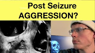 Aggression related to seizures What you need to know [upl. by Dorina]