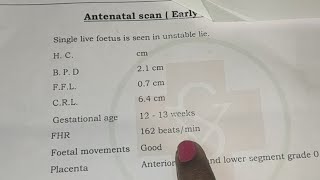 baby boy scanning Reports12weeks baby boy scanning162bpm baby boy or girl baby boy scan reports [upl. by Machos643]