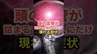 頭の血管が詰まる寸前の人にだけ現れる症状【5選】 長寿命 [upl. by Torrlow]