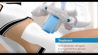 CRISTAL  Medical Cryolipolysis from France [upl. by Bartle255]