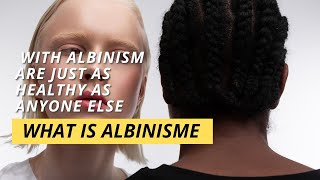 What Is Albinism [upl. by Forkey]