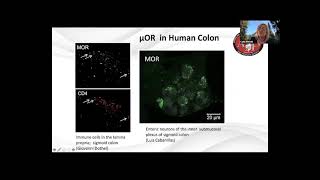 The endocannabinoid system and visceral pain Its relevance to irritable bowel syndrome [upl. by Nonna]