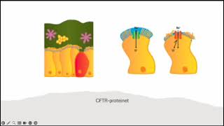 cystisk fibrose [upl. by Lashoh380]