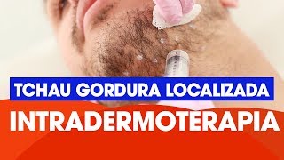 Intradermoterapia [upl. by Retxed]