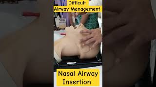 Nasopharyngeal Airway Insertion Technique nursingofficer hospital icunursing airwaymanagement [upl. by Drida]