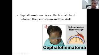 neonate assessment 2 [upl. by Eudoxia]