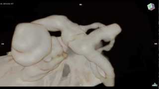 Cochlea  Inner Ear 3D MRI：内耳、蝸牛、三半規管 [upl. by Trilly935]