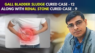 Gall Bladder Sludge Cured Case  12 Along With Renal Stone Cured Case  9  Dr Abhik Ghosh [upl. by Llebyram]