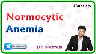 5 Normocytic Anemia  USMLE Step Pathology [upl. by Etnaihc35]