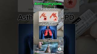 من صالة العمليات امينوفيلين Aminophylline [upl. by Powder391]