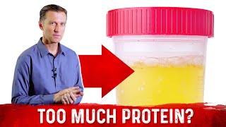 Top 5 Symptoms Of Eating Too Much Protein – DrBerg [upl. by Gelhar665]