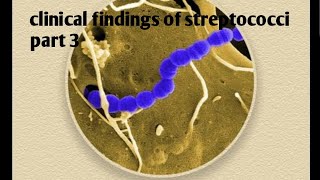 Clinical findings of streptococci  part 3 [upl. by Armando971]